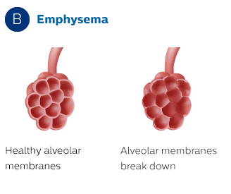 Alveolære membraner
